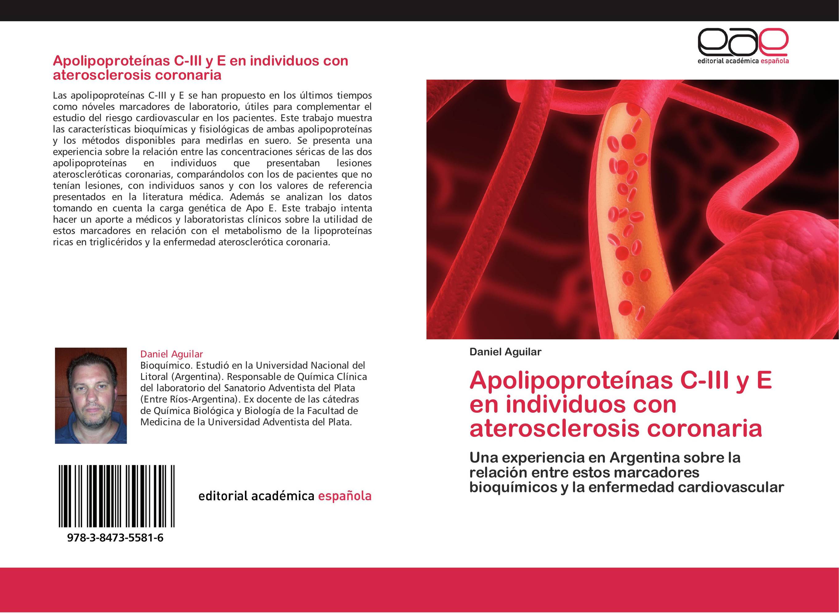 Apolipoproteínas C-III y E en individuos con aterosclerosis coronaria