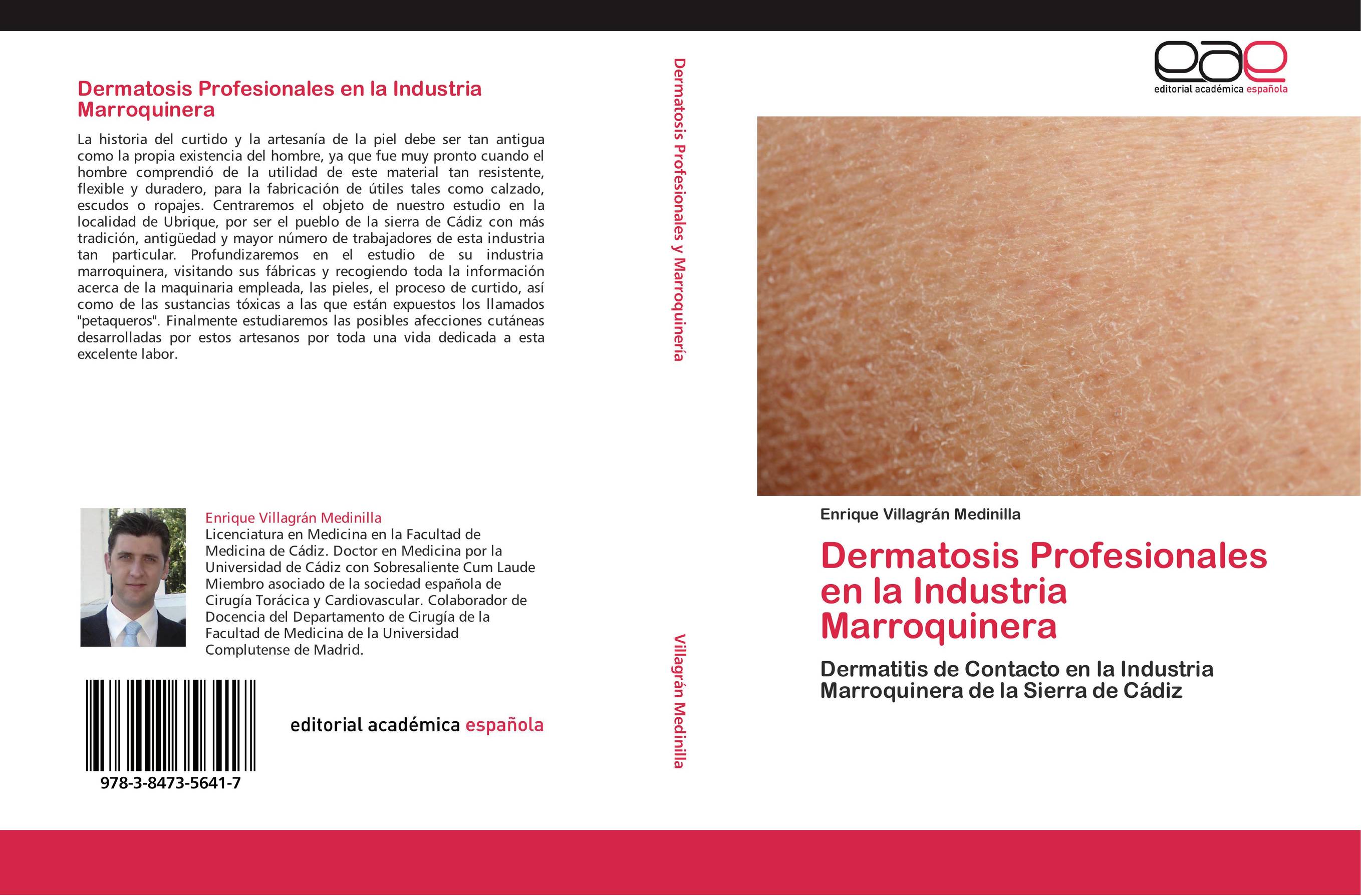 Dermatosis Profesionales en la Industria Marroquinera