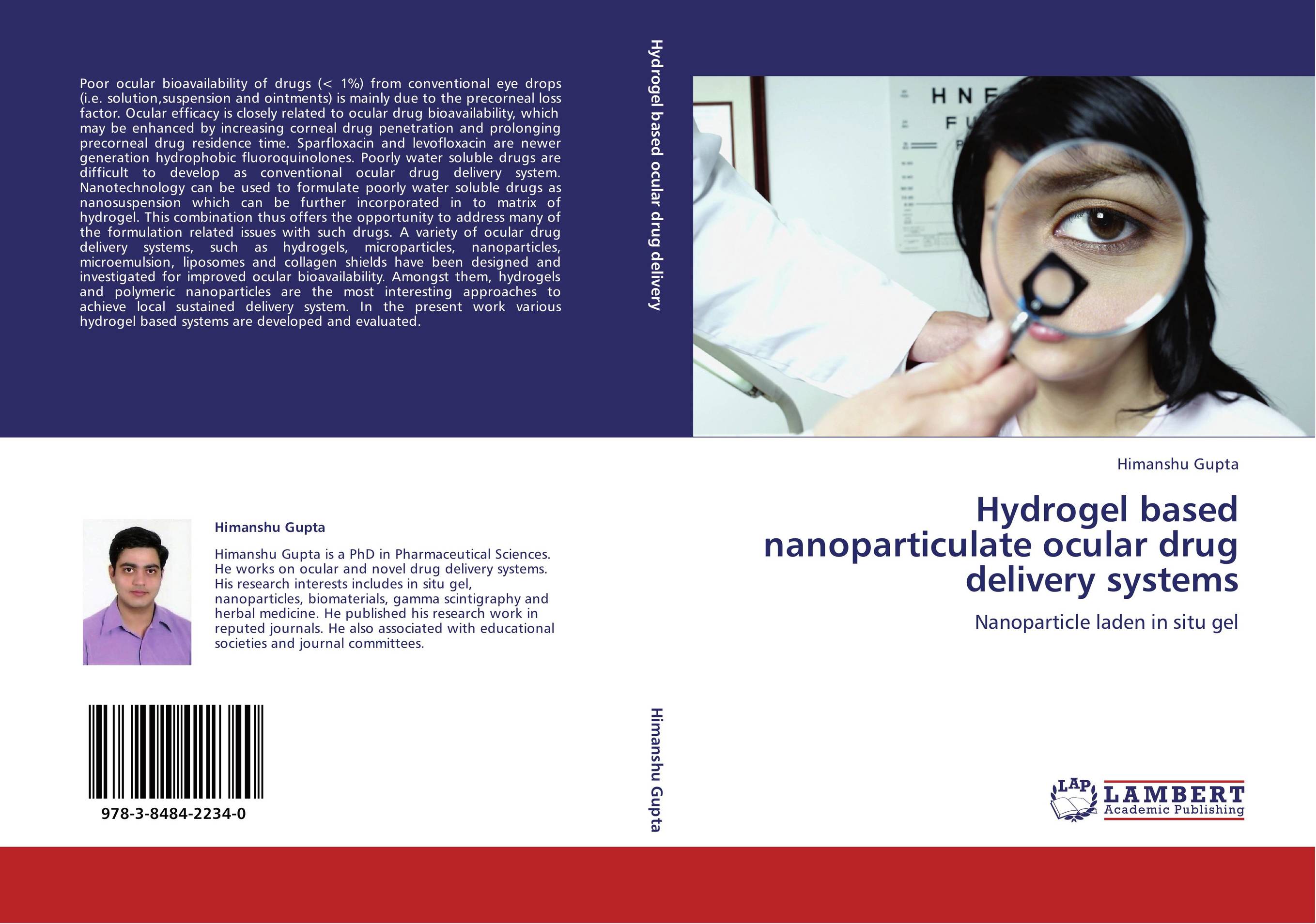 Hydrogel based nanoparticulate ocular drug delivery systems. Nanoparticle laden in situ gel.