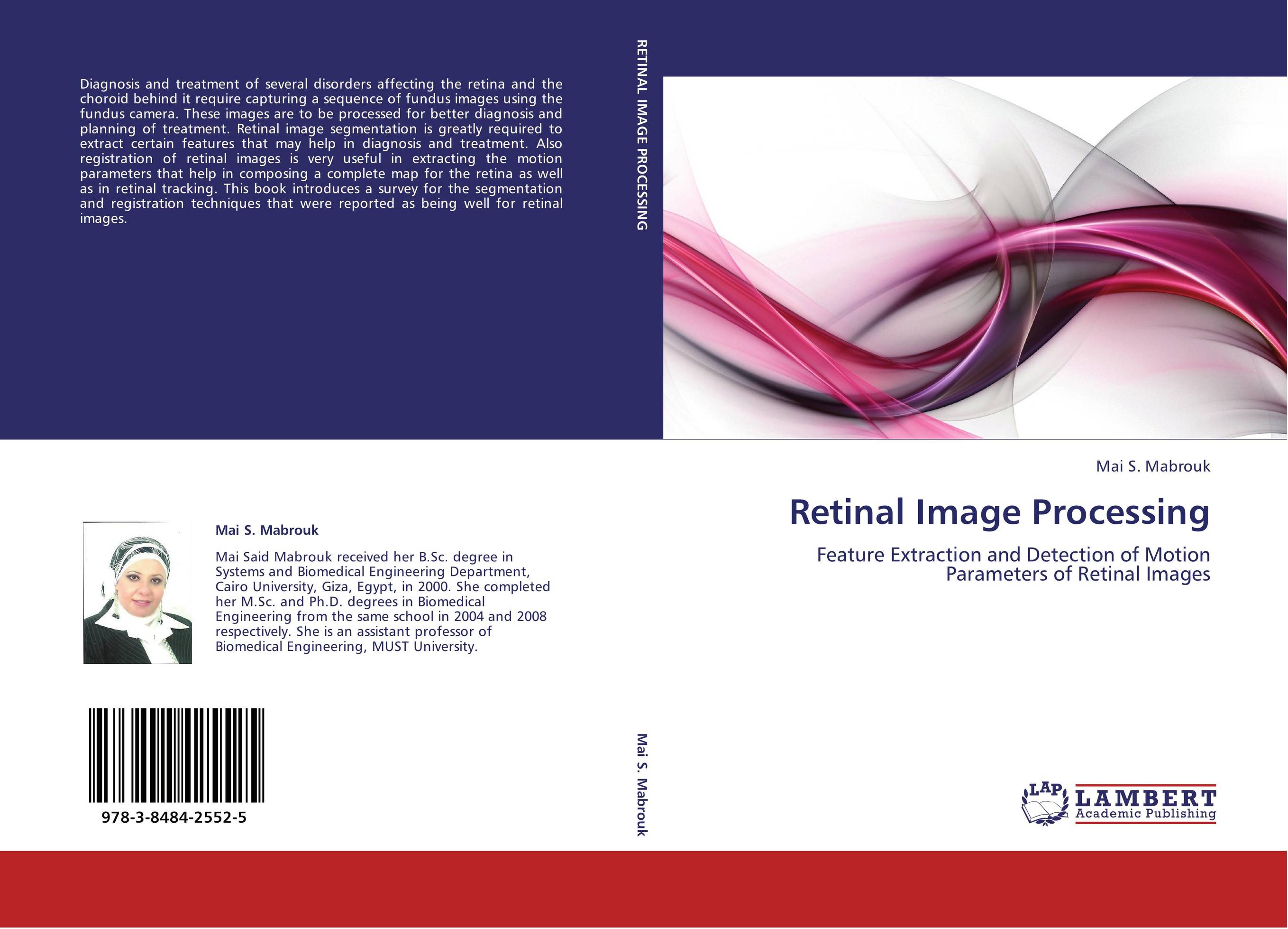 Retinal Image Processing. Feature Extraction and Detection of Motion Parameters of Retinal Images.