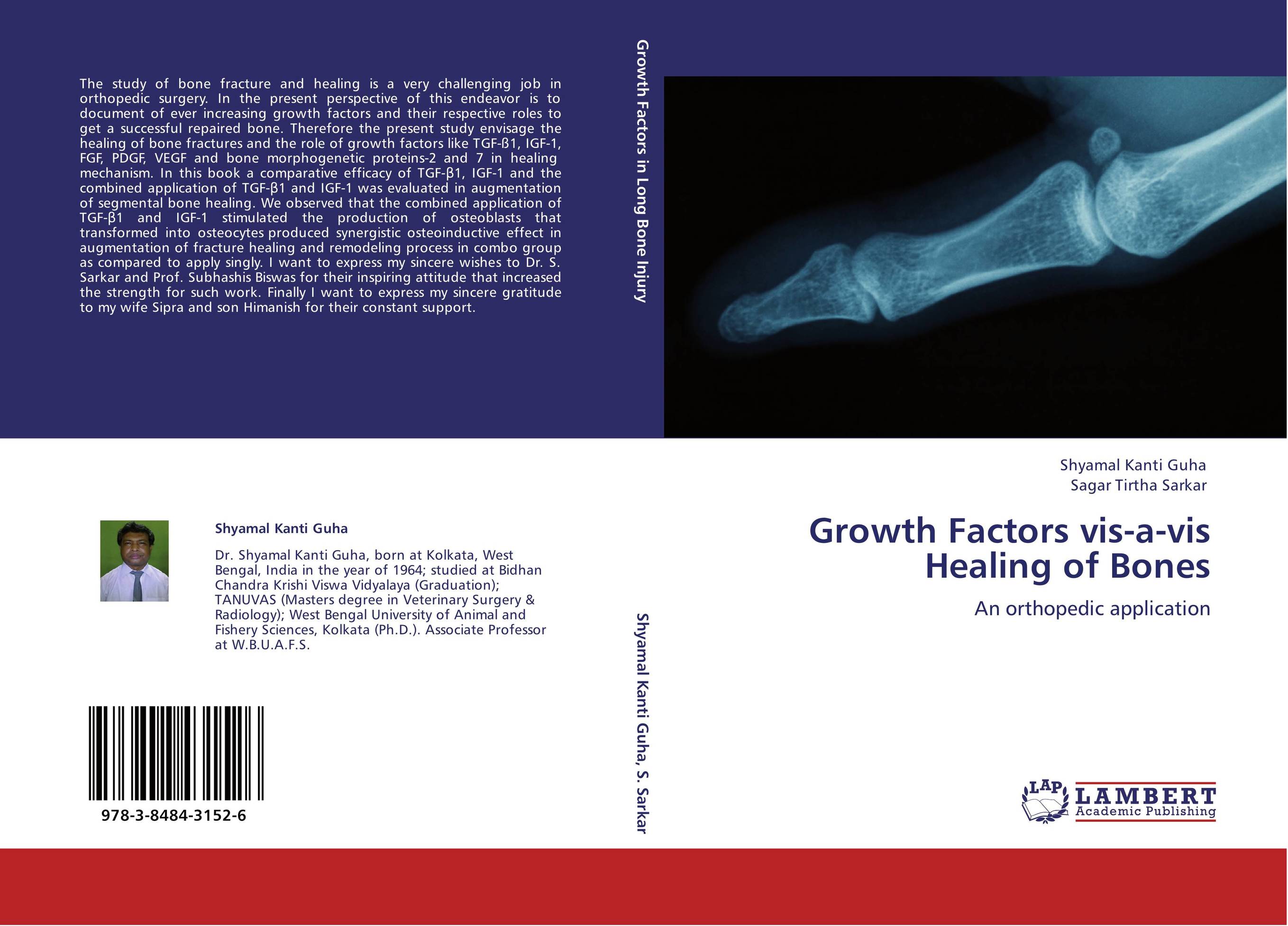 Growth Factors vis-a-vis Healing of Bones. An orthopedic application.