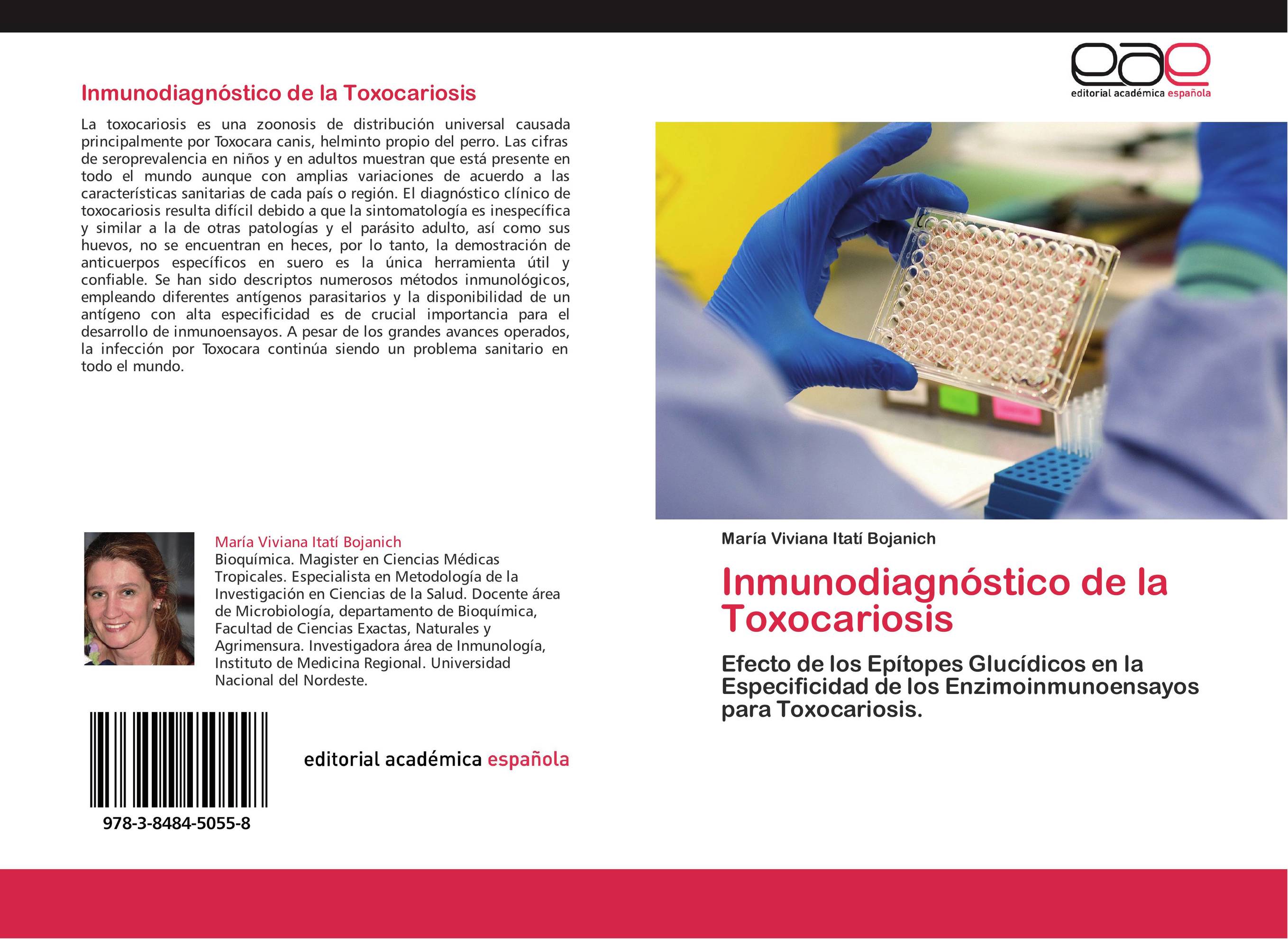 Inmunodiagnóstico de la Toxocariosis
