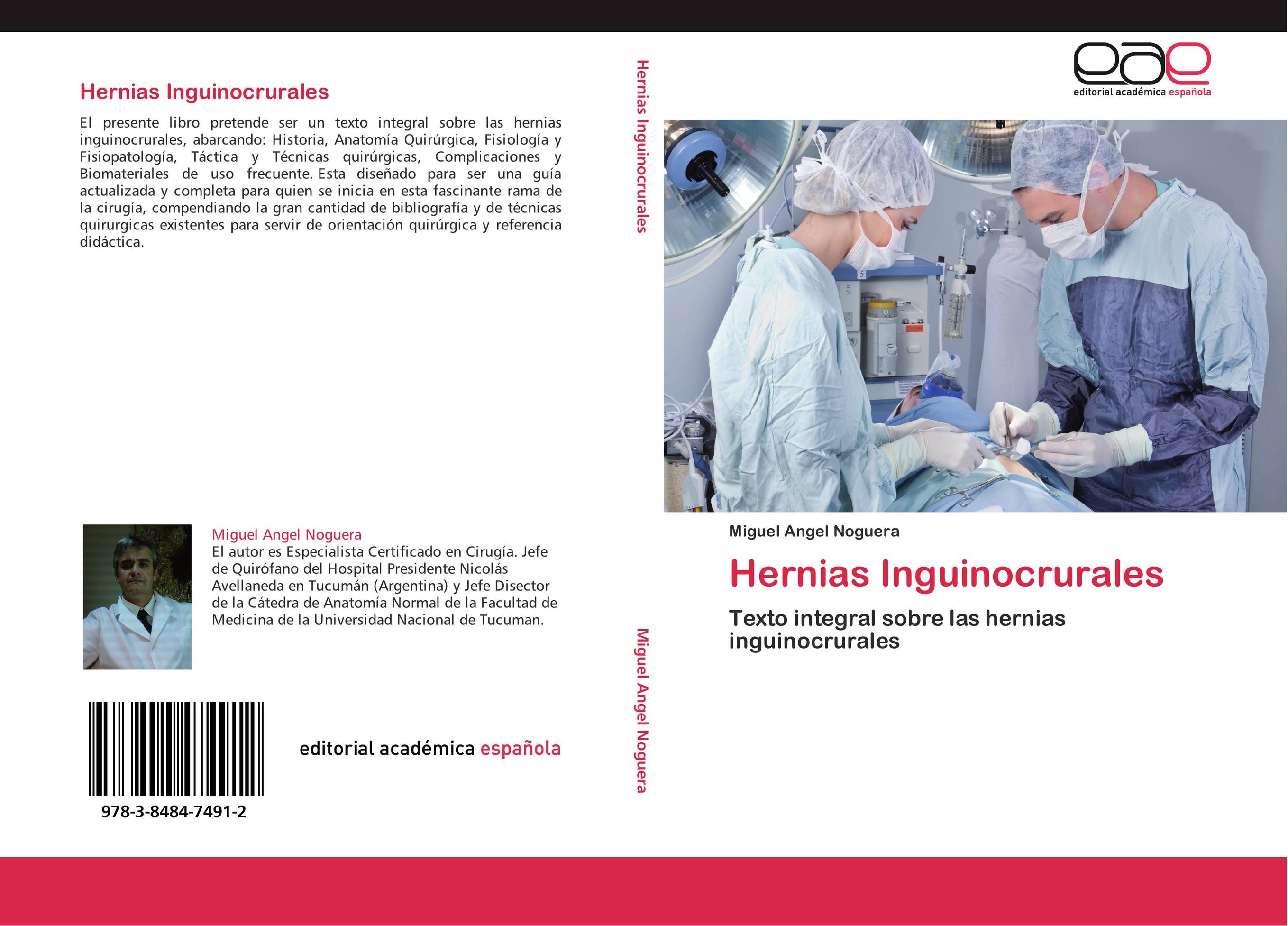 Hernias Inguinocrurales