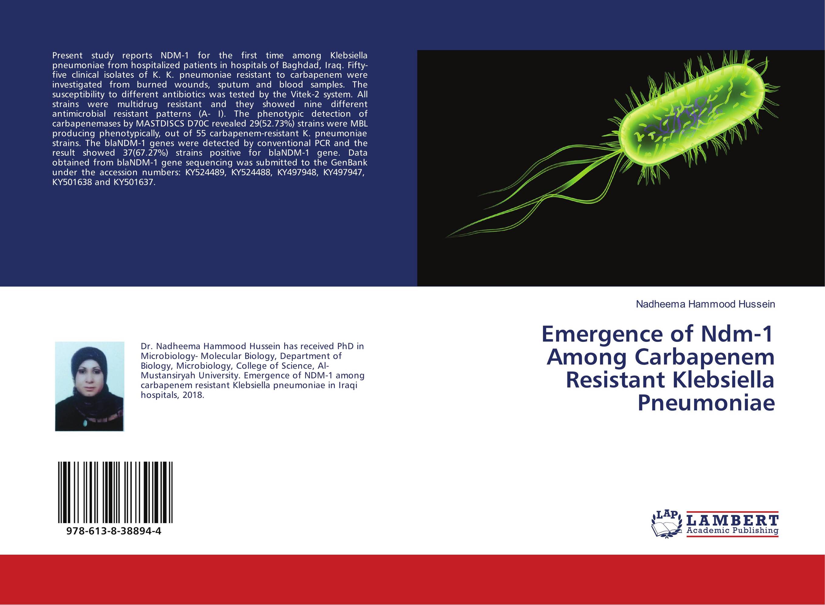 Emergence of Ndm-1 Among Carbapenem Resistant Klebsiella Pneumoniae..