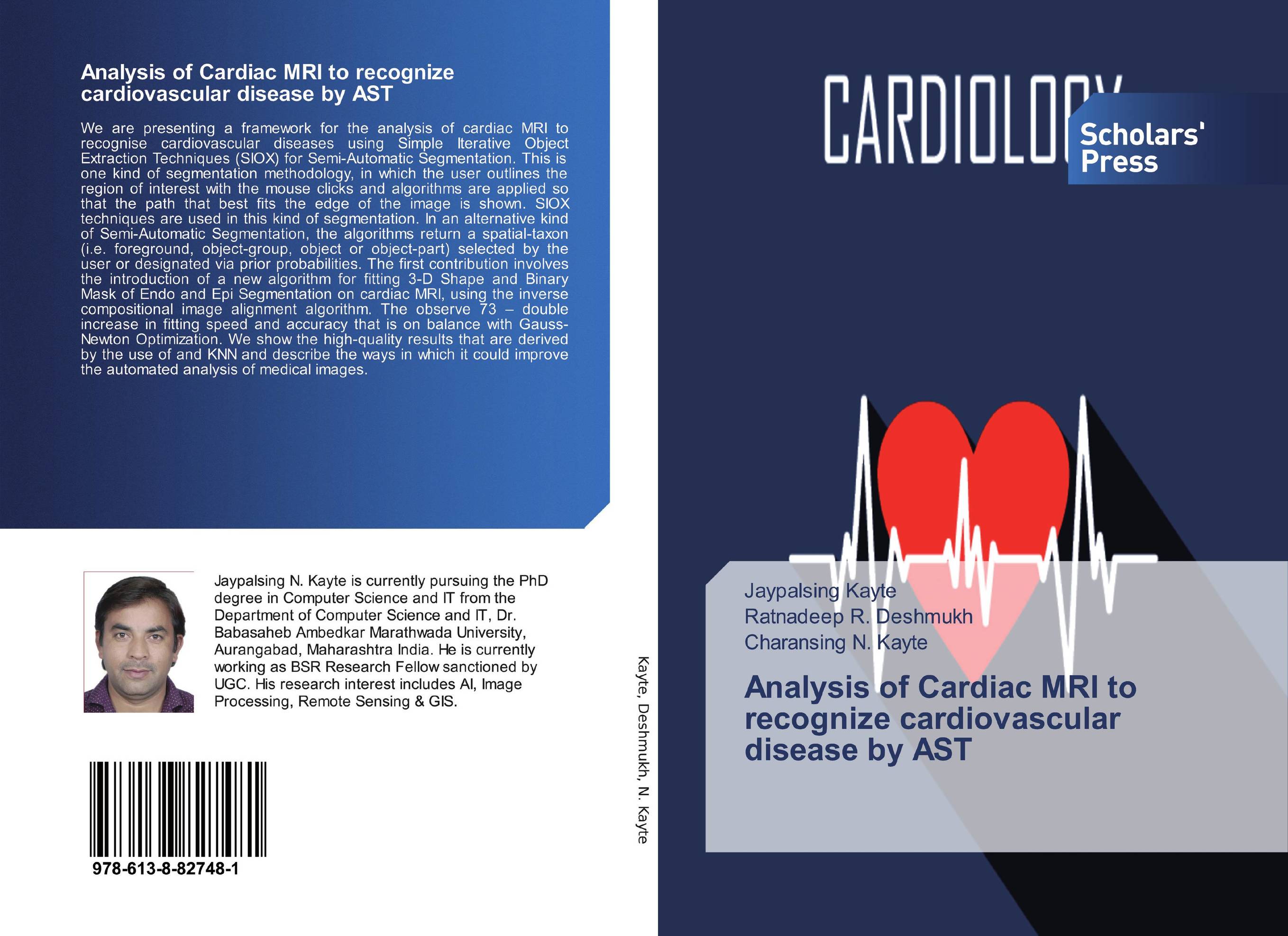 Analysis of Cardiac MRI to recognize cardiovascular disease by AST..
