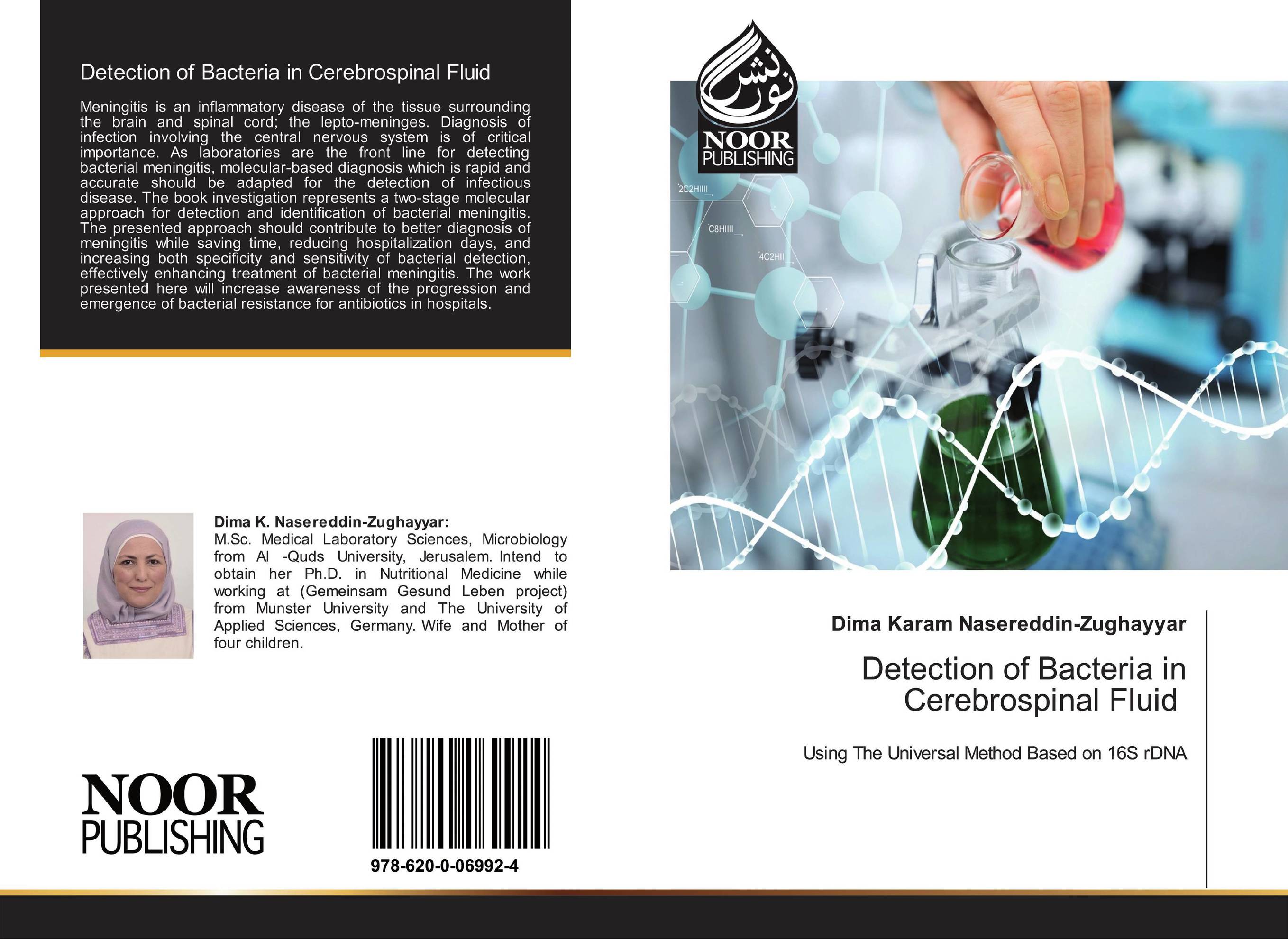 Detection of Bacteria in Cerebrospinal Fluid. Using The Universal Method Based on 16S rDNA.