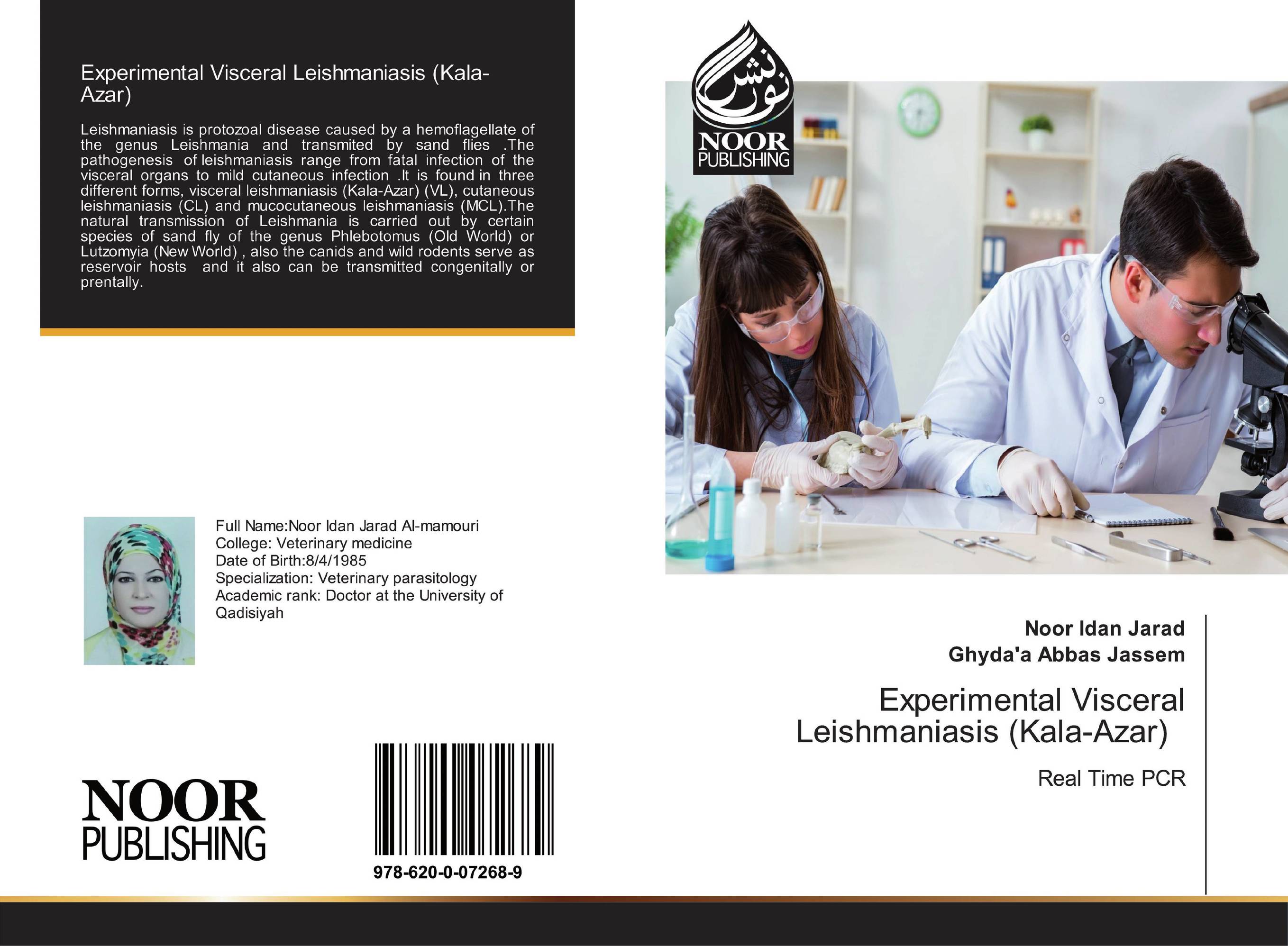 Experimental Visceral Leishmaniasis (Kala-Azar). Real Time PCR.