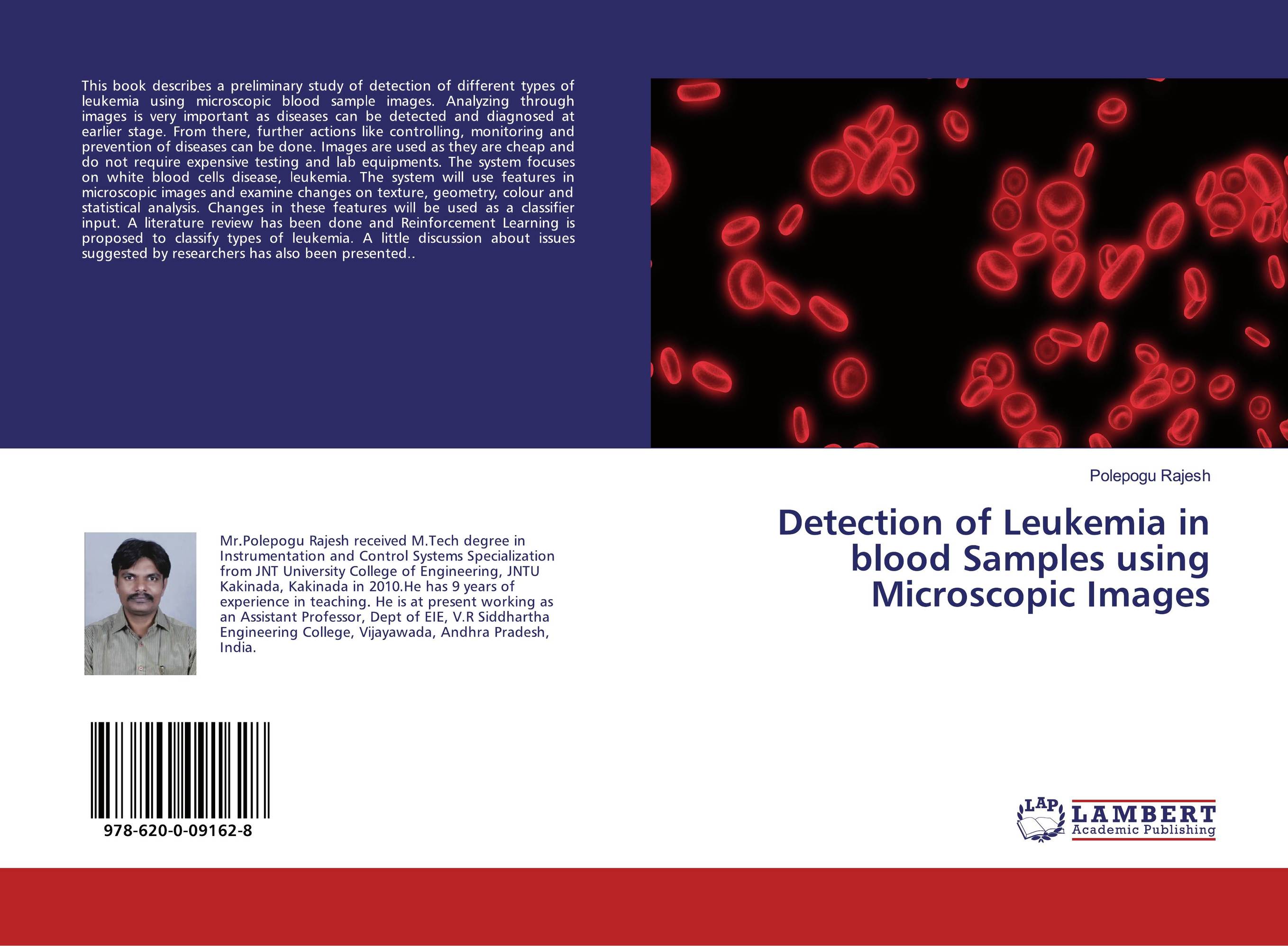 Detection of Leukemia in blood Samples using Microscopic Images..