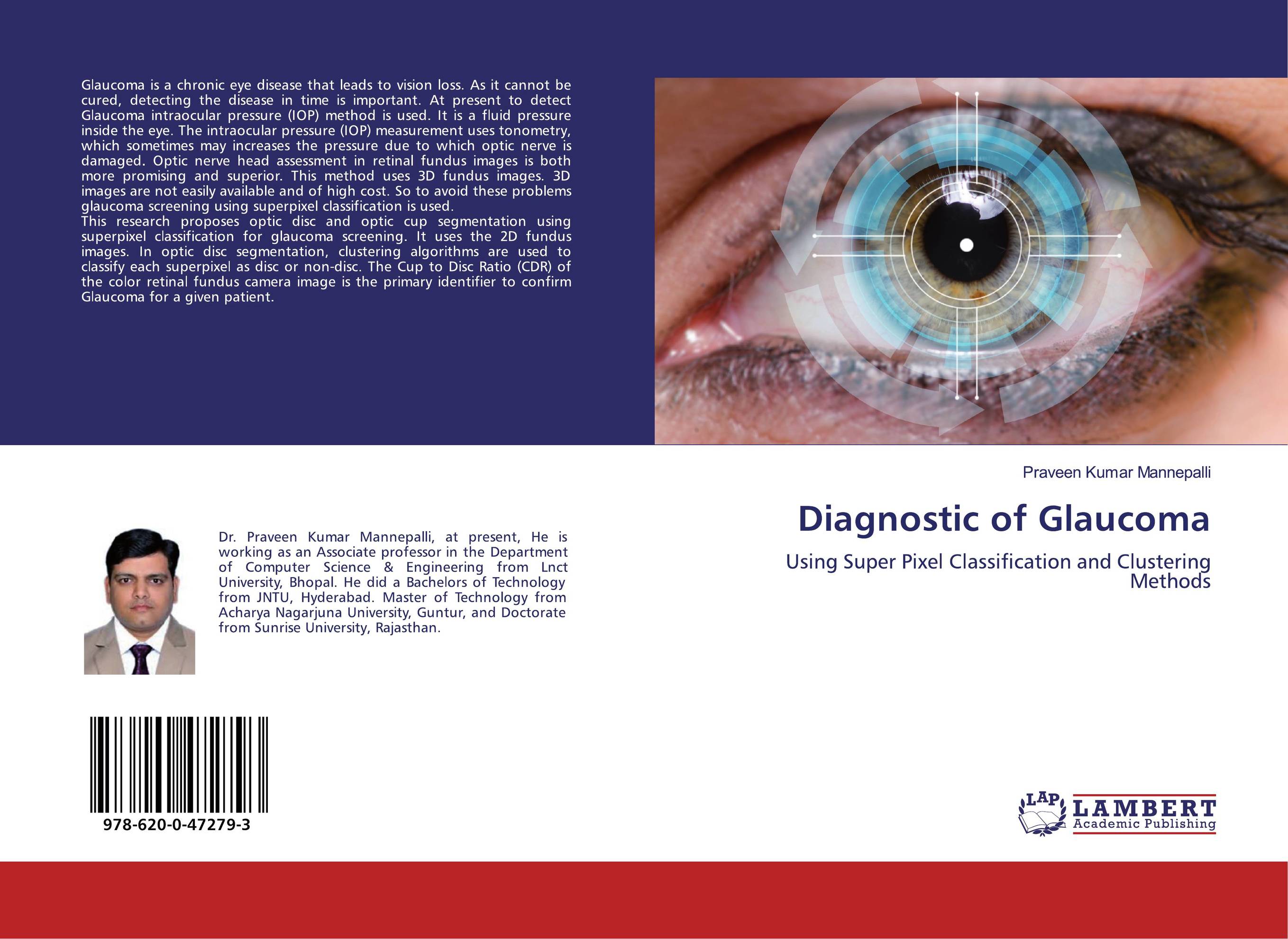 Diagnostic of Glaucoma. Using Super Pixel Classification and Clustering Methods.