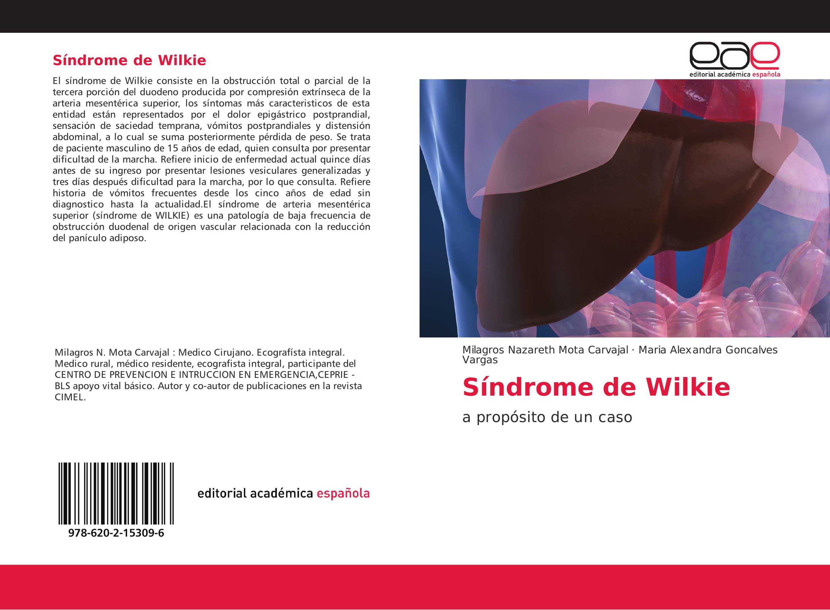 abordar impots des no residentes