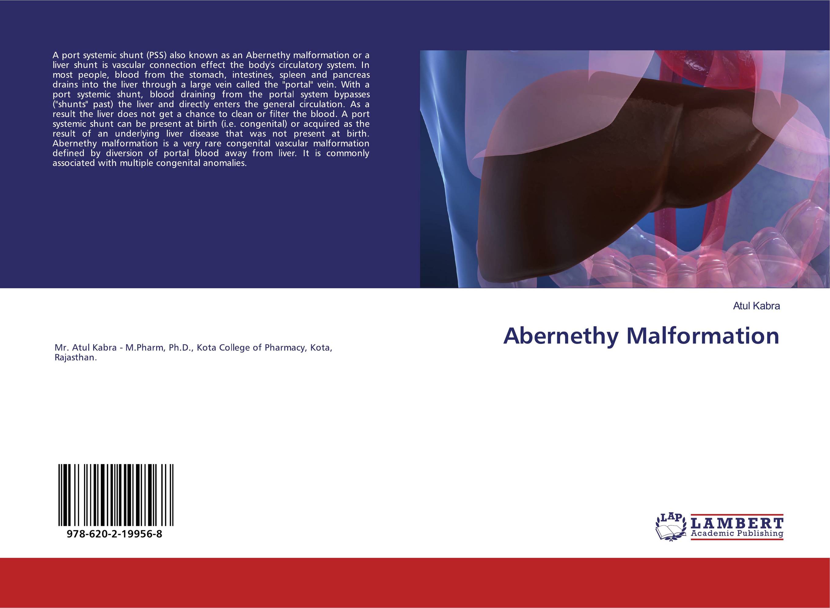 Abernethy Malformation..