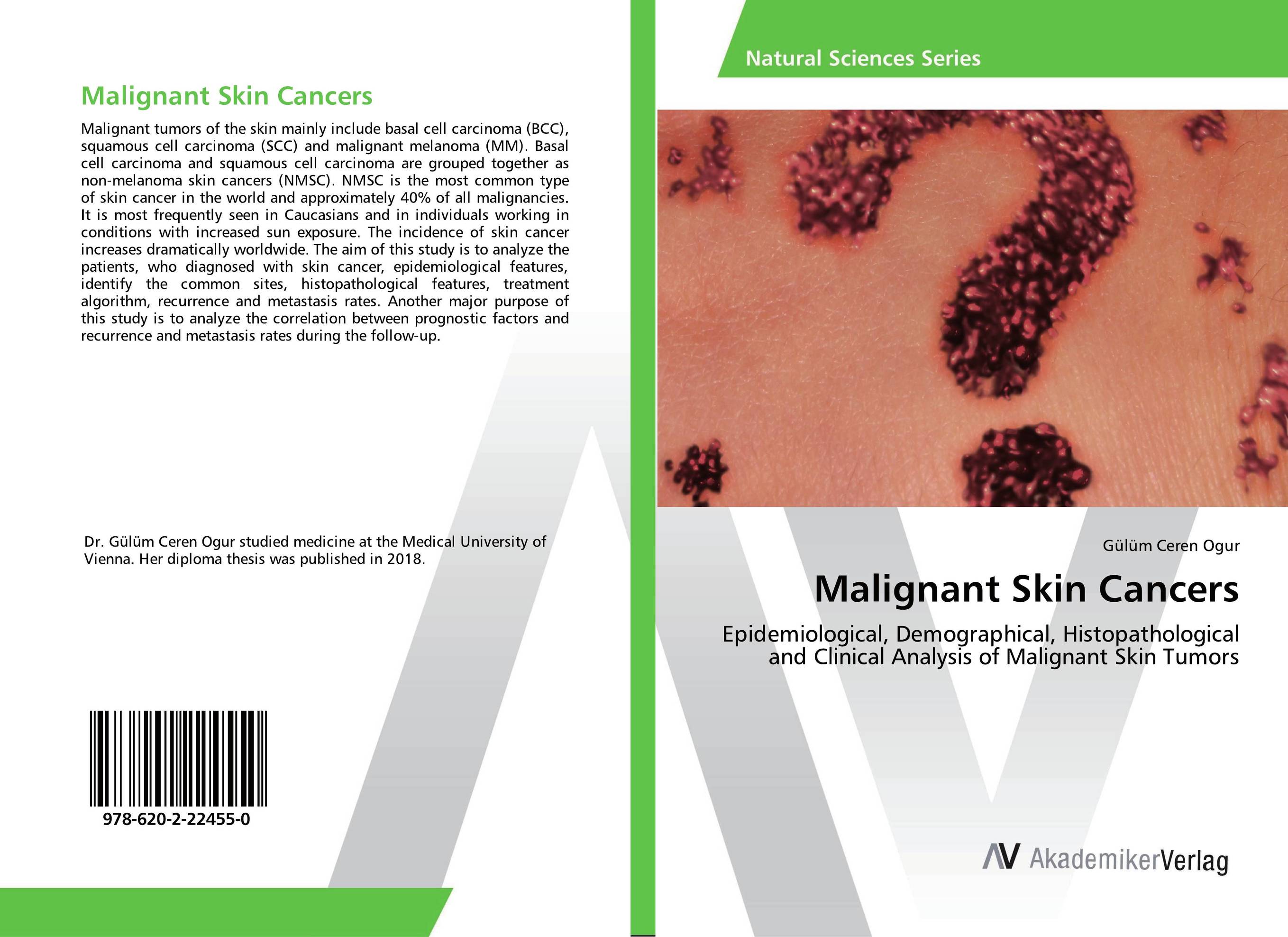 Malignant Skin Cancers. Epidemiological, Demographical, Histopathological and Clinical Analysis of Malignant Skin Tumors.