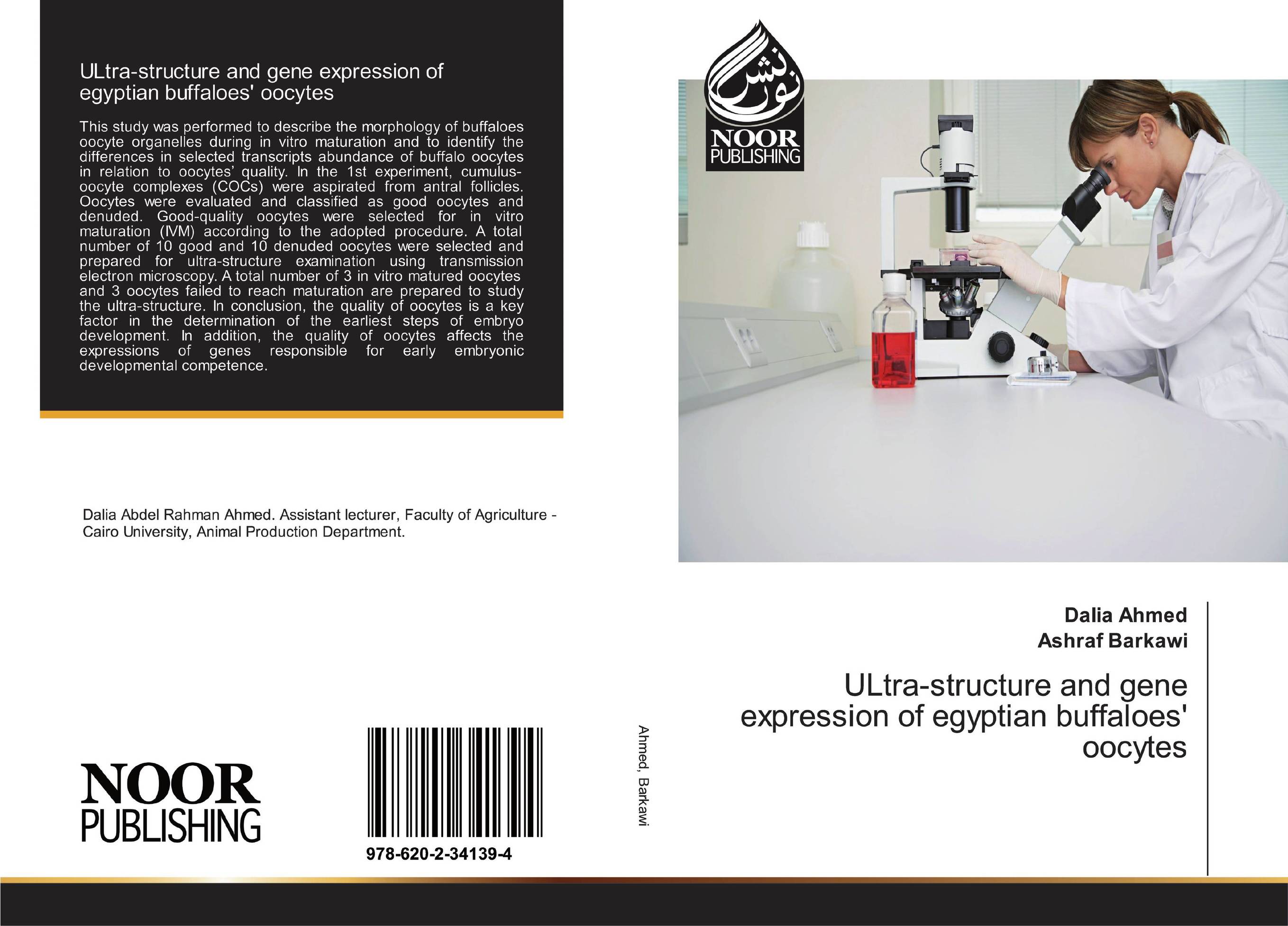 ULtra-structure and gene expression of egyptian buffaloes' oocytes..