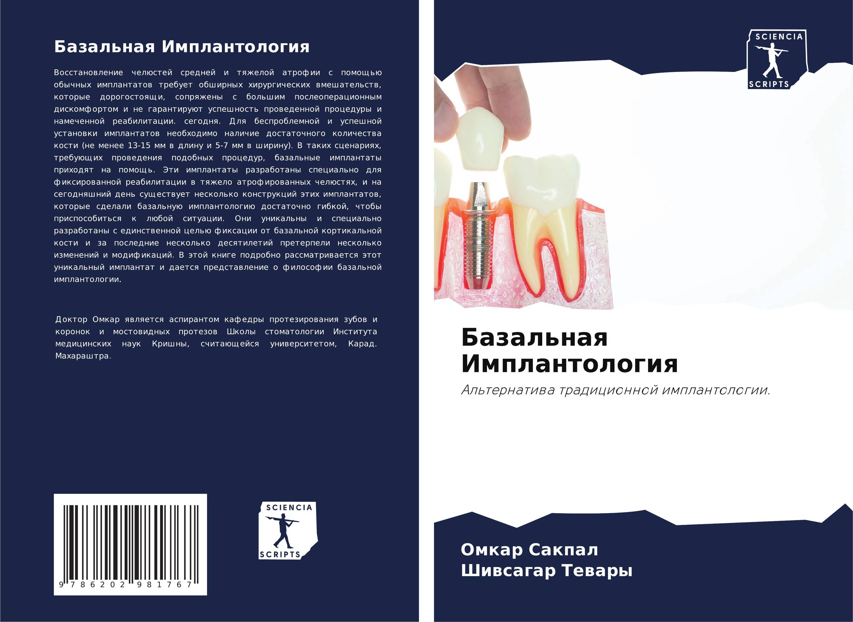 Базальная Имплантология. Альтернатива традиционной имплантологии..